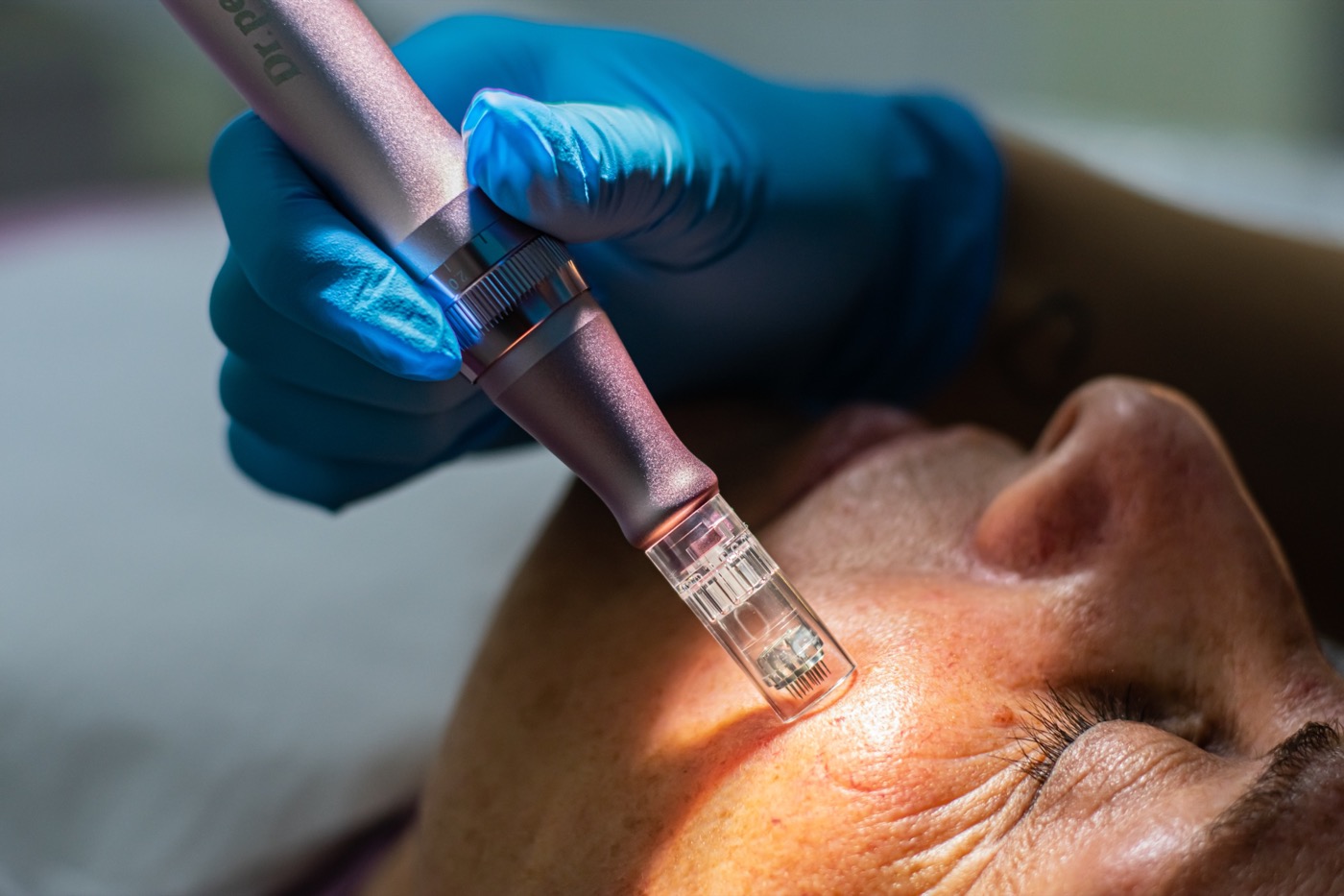 Procedimiento de estética facial en consulta