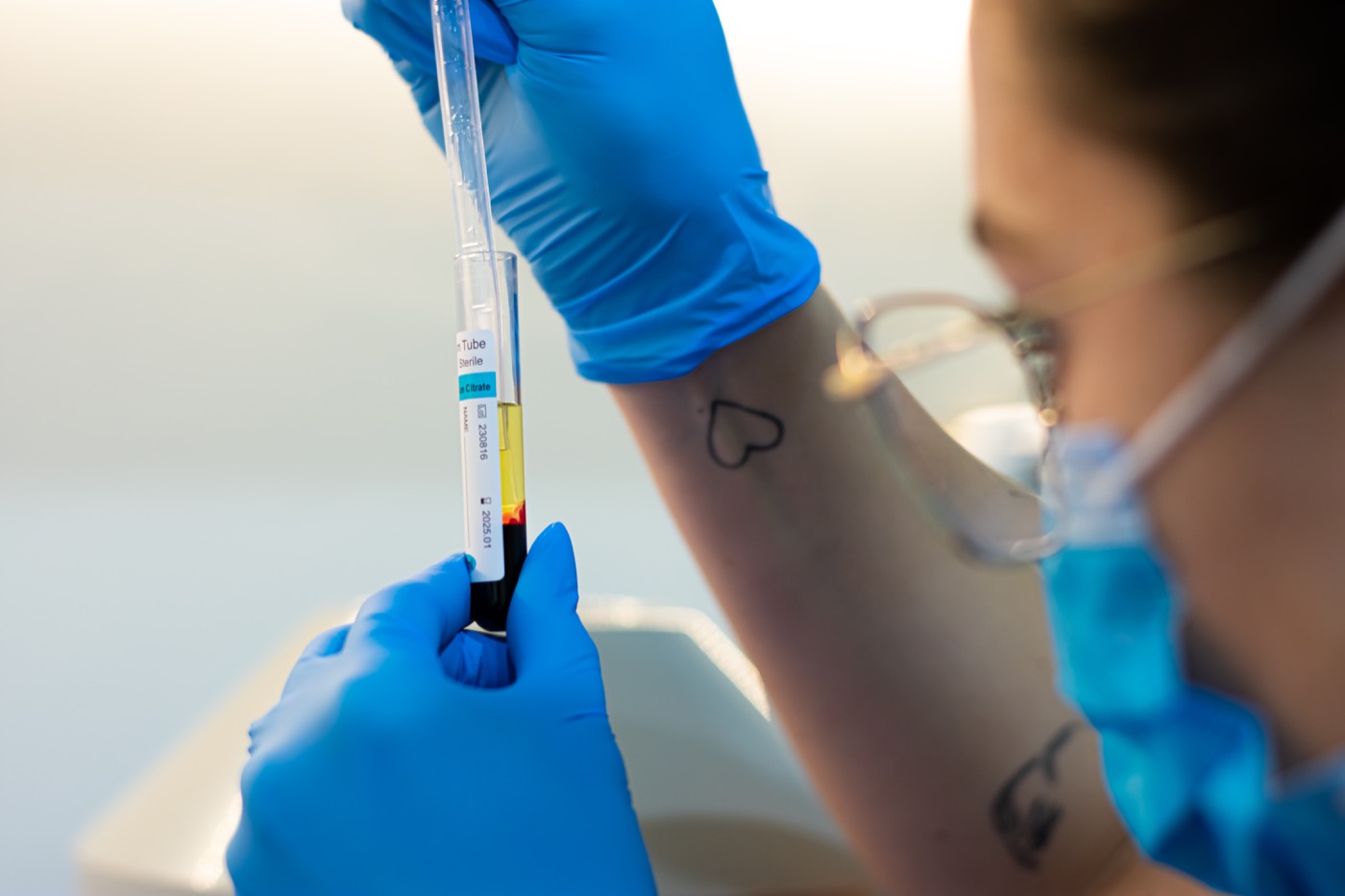 Preparación de plasma rico en plaquetas