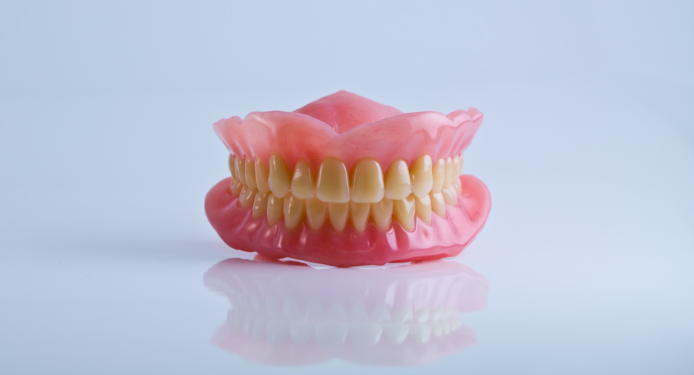 Modelo de prótesis removible en laboratorio dental